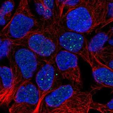 Anti-FAM69B antibody produced in rabbit Prestige Antibodies&#174; Powered by Atlas Antibodies, affinity isolated antibody