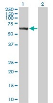 Anti-STK33 antibody produced in rabbit purified immunoglobulin, buffered aqueous solution