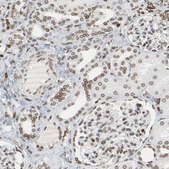 Anti-PRKAG2 antibody produced in rabbit Prestige Antibodies&#174; Powered by Atlas Antibodies, affinity isolated antibody, buffered aqueous glycerol solution