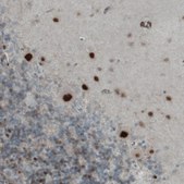 Monoclonal Anti-MEF2C antibody produced in mouse Prestige Antibodies&#174; Powered by Atlas Antibodies, clone CL0368, purified immunoglobulin, buffered aqueous glycerol solution