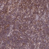 Anti-POLA2 antibody produced in rabbit Prestige Antibodies&#174; Powered by Atlas Antibodies, affinity isolated antibody, buffered aqueous glycerol solution