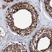 Anti-HSPA5 antibody produced in rabbit Prestige Antibodies&#174; Powered by Atlas Antibodies, affinity isolated antibody, buffered aqueous glycerol solution