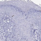 Anti-HLA-DQB2 antibody produced in rabbit Prestige Antibodies&#174; Powered by Atlas Antibodies, affinity isolated antibody, buffered aqueous glycerol solution