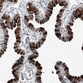 Anti-RSPH4A antibody produced in rabbit Prestige Antibodies&#174; Powered by Atlas Antibodies, affinity isolated antibody, buffered aqueous glycerol solution