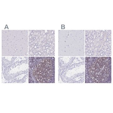 Anti-IKZF1 antibody produced in rabbit Prestige Antibodies&#174; Powered by Atlas Antibodies, affinity isolated antibody, buffered aqueous glycerol solution