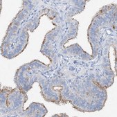 Anti-MAGI1 antibody produced in rabbit Prestige Antibodies&#174; Powered by Atlas Antibodies, affinity isolated antibody, buffered aqueous glycerol solution, ab2