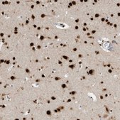 Anti-BCLAF1 antibody produced in rabbit Prestige Antibodies&#174; Powered by Atlas Antibodies, affinity isolated antibody, buffered aqueous glycerol solution