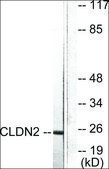 Anti-Claudin 2 antibody produced in rabbit affinity isolated antibody