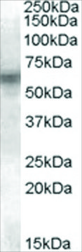 Anti-LYN antibody produced in goat affinity isolated antibody, buffered aqueous solution