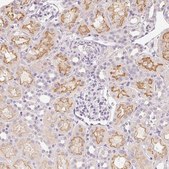 Anti-SLC6A18 antibody produced in rabbit Prestige Antibodies&#174; Powered by Atlas Antibodies, affinity isolated antibody, buffered aqueous glycerol solution