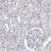 Anti-TNR antibody produced in rabbit Prestige Antibodies&#174; Powered by Atlas Antibodies, affinity isolated antibody, buffered aqueous glycerol solution, Ab2