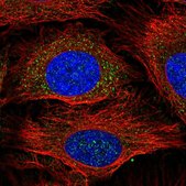 Anti-GSTM1 antibody produced in rabbit Prestige Antibodies&#174; Powered by Atlas Antibodies, affinity isolated antibody, buffered aqueous glycerol solution