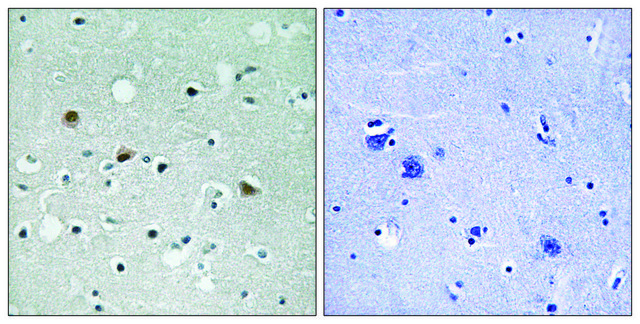 Anti-phospho-LATS1/2 (pThr1079/1041) antibody produced in rabbit affinity isolated antibody