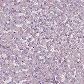 Anti-ATG16L1 antibody produced in rabbit Prestige Antibodies&#174; Powered by Atlas Antibodies, affinity isolated antibody, buffered aqueous glycerol solution