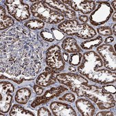 Anti-IDH3B antibody produced in rabbit Prestige Antibodies&#174; Powered by Atlas Antibodies, affinity isolated antibody, buffered aqueous glycerol solution