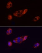 Anti-Perilipin-2 Antibody, clone 9W7Y9, Rabbit Monoclonal