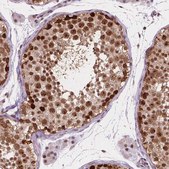 Anti-PER2 antibody produced in rabbit Prestige Antibodies&#174; Powered by Atlas Antibodies, affinity isolated antibody, buffered aqueous glycerol solution