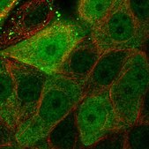 Anti-LXN antibody produced in rabbit Prestige Antibodies&#174; Powered by Atlas Antibodies, affinity isolated antibody, buffered aqueous glycerol solution