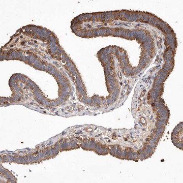 Anti-COQ8B antibody produced in rabbit Prestige Antibodies&#174; Powered by Atlas Antibodies, affinity isolated antibody, buffered aqueous glycerol solution, ab1