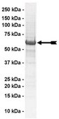 Src Protein, 10 &#181;g Full length, recombinant human Src. N-terminal c-Myc, 6His-tagged. For use in Enzyme Assays. Functions as a substrate in ubiquitination assays.