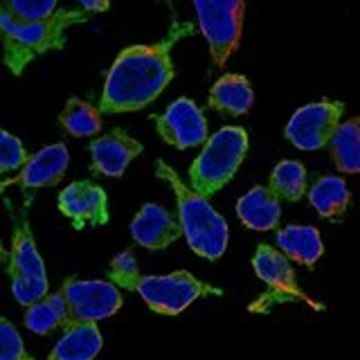 Anti-RCSD1 antibody produced in rabbit Prestige Antibodies&#174; Powered by Atlas Antibodies, affinity isolated antibody, buffered aqueous glycerol solution