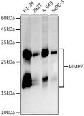 Anti-MMP7 Antibody, clone 9D8S10, Rabbit Monoclonal