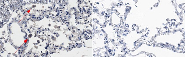 Anti-IL-1&#946; Antibody, clone 11G7.3.7