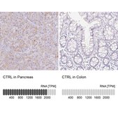 Anti-CTRL antibody produced in rabbit Prestige Antibodies&#174; Powered by Atlas Antibodies, affinity isolated antibody, buffered aqueous glycerol solution