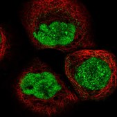 Anti-DCLRE1A antibody produced in rabbit Prestige Antibodies&#174; Powered by Atlas Antibodies, affinity isolated antibody, buffered aqueous glycerol solution