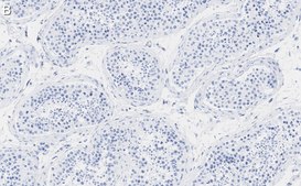 Anti-PPP3CC Antibody, clone 2C2 ZooMAb&#174; Rabbit Monoclonal recombinant, expressed in HEK 293 cells