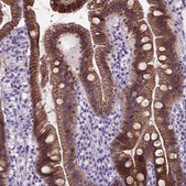 Monoclonal Anti-CDH1 antibody produced in mouse Prestige Antibodies&#174; Powered by Atlas Antibodies, clone CL1170, purified immunoglobulin, buffered aqueous glycerol solution