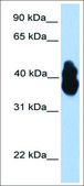 Anti-OLIG2 (AB2) antibody produced in rabbit affinity isolated antibody