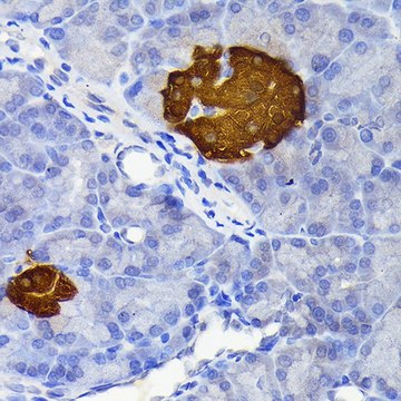 Anti-Secretagogin (SCGN) antibody produced in rabbit