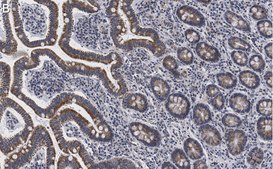 Anti-LONP1 Antibody, clone 1I18, ZooMAb&#174; Rabbit Monoclonal recombinant, expressed in HEK 293 cells