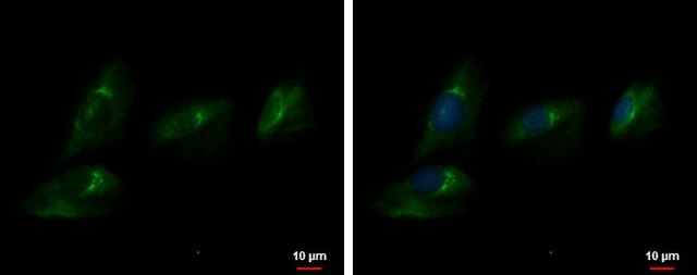 Anti-ENPP2 antibody produced in rabbit affinity isolated antibody, buffered aqueous solution