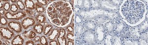 Anti-Clathrin Heavy Chain Antibody, clone 1C6 ZooMAb&#174; Rabbit Monoclonal recombinant, expressed in HEK 293 cells