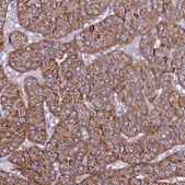 Anti-TMEM106C antibody produced in rabbit Prestige Antibodies&#174; Powered by Atlas Antibodies, affinity isolated antibody, buffered aqueous glycerol solution
