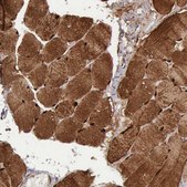 Anti-FHL1 antibody produced in rabbit Prestige Antibodies&#174; Powered by Atlas Antibodies, affinity isolated antibody, buffered aqueous glycerol solution, Ab1