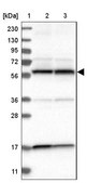 Anti-PPP3CC antibody produced in rabbit Prestige Antibodies&#174; Powered by Atlas Antibodies, affinity isolated antibody, buffered aqueous glycerol solution