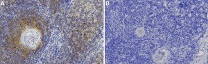 Anti-IRF7 Antibody, clone 3B22 ZooMAb&#174; Rabbit Monoclonal recombinant, expressed in HEK 293 cells
