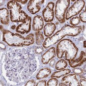 Anti-TMEM206 antibody produced in rabbit Prestige Antibodies&#174; Powered by Atlas Antibodies, affinity isolated antibody, buffered aqueous glycerol solution