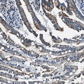 Anti-OGDH antibody produced in rabbit Prestige Antibodies&#174; Powered by Atlas Antibodies, affinity isolated antibody, buffered aqueous glycerol solution