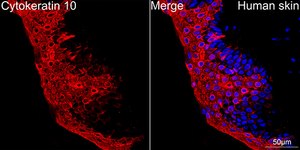 Anti-Cytokeratin 10 Antibody, clone 4S5Y7, Rabbit Monoclonal