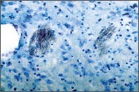Anti-Purinergic Receptor P2Y1 antibody produced in rabbit affinity isolated antibody, lyophilized powder