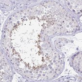 Anti-IRGC antibody produced in rabbit Prestige Antibodies&#174; Powered by Atlas Antibodies, affinity isolated antibody, buffered aqueous glycerol solution