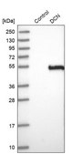 Anti-DCN antibody produced in rabbit Prestige Antibodies&#174; Powered by Atlas Antibodies, affinity isolated antibody, buffered aqueous glycerol solution