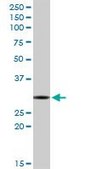 Anti-RNASEH2A antibody produced in rabbit purified immunoglobulin, buffered aqueous solution