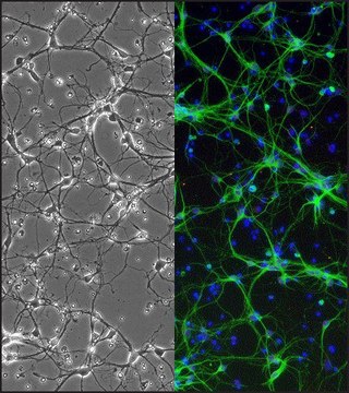 Rat Striatal Neurons: RStN