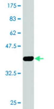 Monoclonal Anti-KRT13 antibody produced in mouse clone 4F5, purified immunoglobulin, buffered aqueous solution