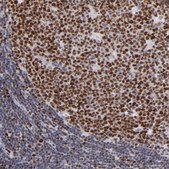 Anti-POLA1 antibody produced in rabbit Prestige Antibodies&#174; Powered by Atlas Antibodies, affinity isolated antibody, buffered aqueous glycerol solution